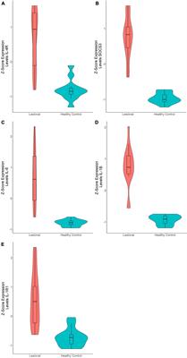 In silico Identification of Immune Cell-Types and Pathways Involved in Chronic Spontaneous Urticaria